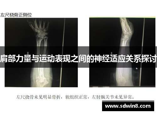 肩部力量与运动表现之间的神经适应关系探讨